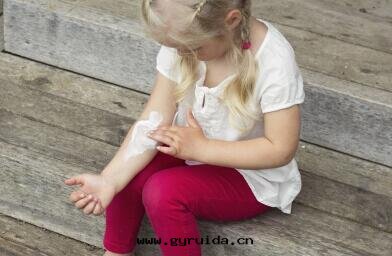 燙傷後(hòu)吃这(zhè)些食物(wù)傷口不(bù)易愈合