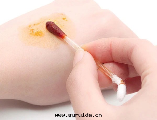 酒(jiǔ)精消毒和(hé)碘伏消毒:分(fēn)别适用(yòng)在(zài)那(nà)些场(chǎng)景中使用(yòng),如(rú)何區(qū)别呢?