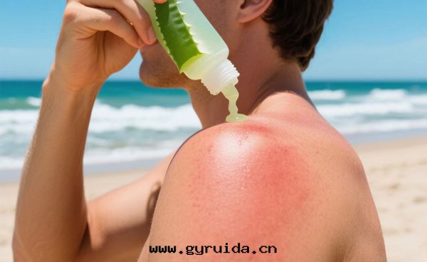 高(gāo)温(wēn)預警!这(zhè)份曬傷急救指南(nán)收藏好(hǎo)