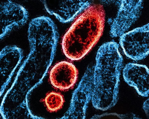 致(zhì)死率最(zuì)高(gāo)75%！印(yìn)度(dù)再爆尼帕病毒疫情(qíng)，会(huì)演變(biàn)成全(quán)球大(dà)流行嗎？